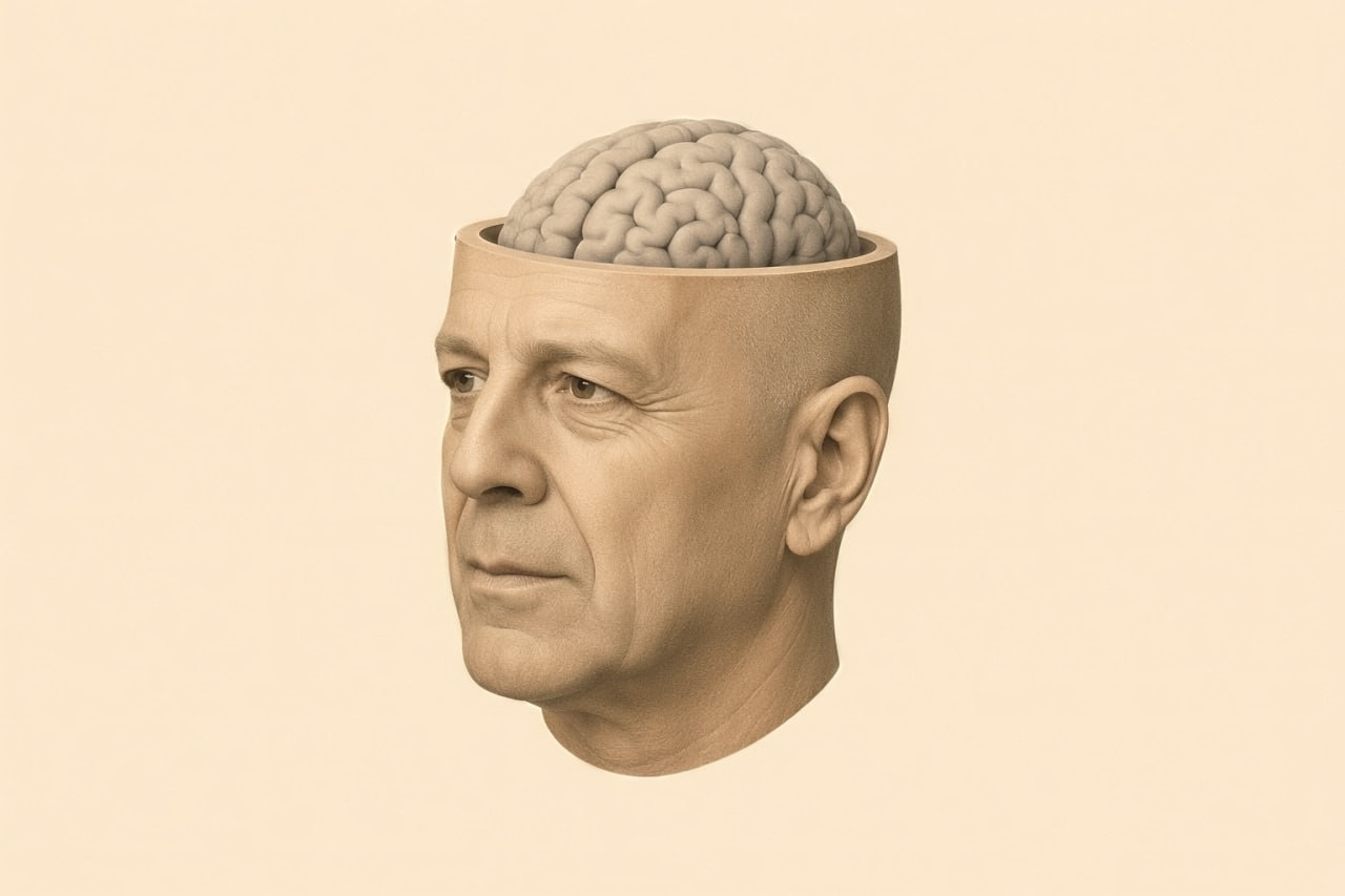 El legado de Bruce Willis: donación de su cerebro para la investigación de la DFT